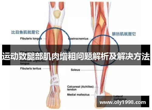 运动致腿部肌肉增粗问题解析及解决方法